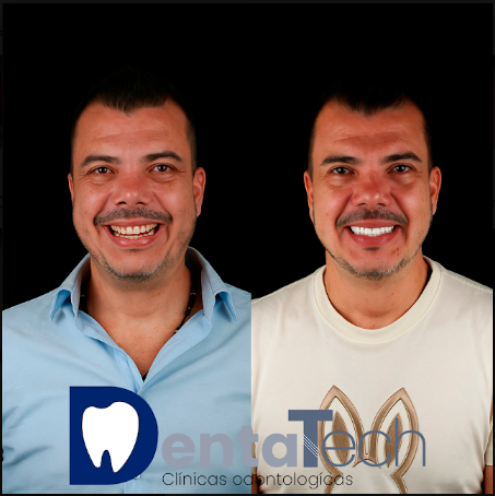 Clinica odontológica en Cali