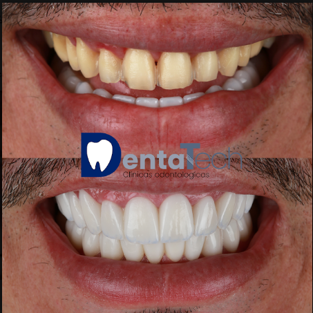 Clinica odontológica en Cali